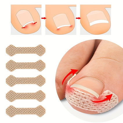 Ingrown Toenail Corrector