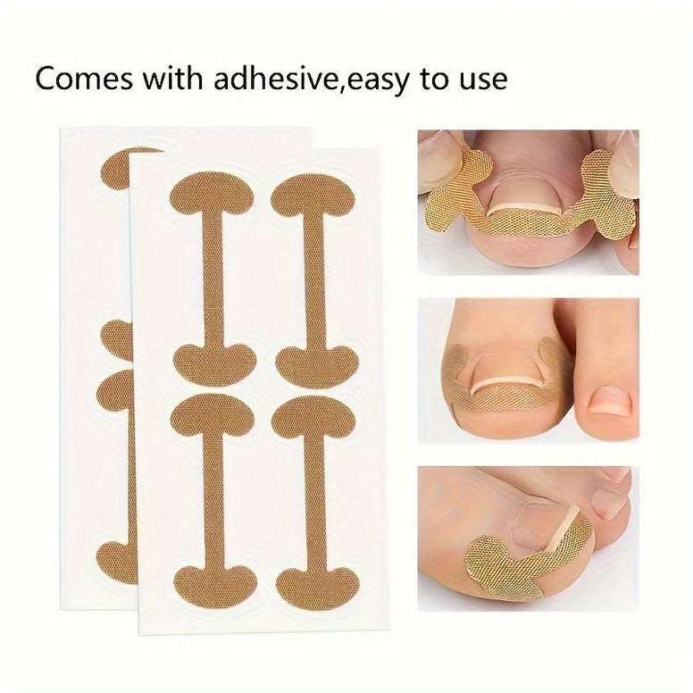 Ingrown Nail Correction Bandage for Relief from Paronychia and Nail Issues 5 Sheets 20 pieces