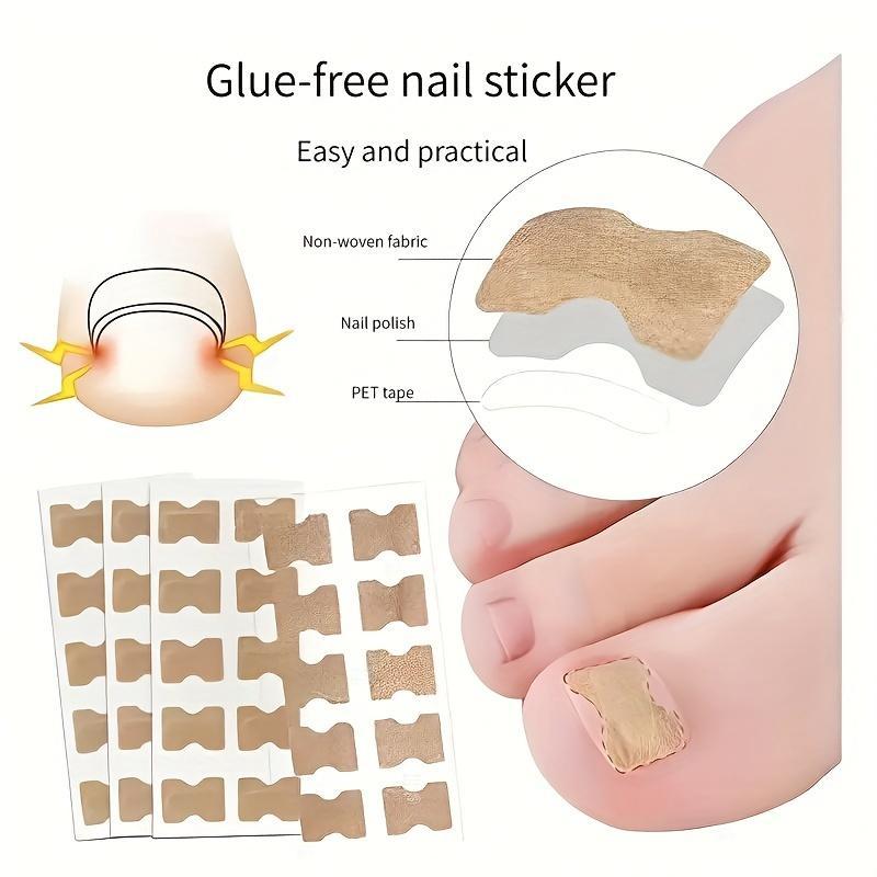 Ingrown Nail Correction Bandage for Relief from Paronychia and Nail Issues 5 Sheets 20 pieces