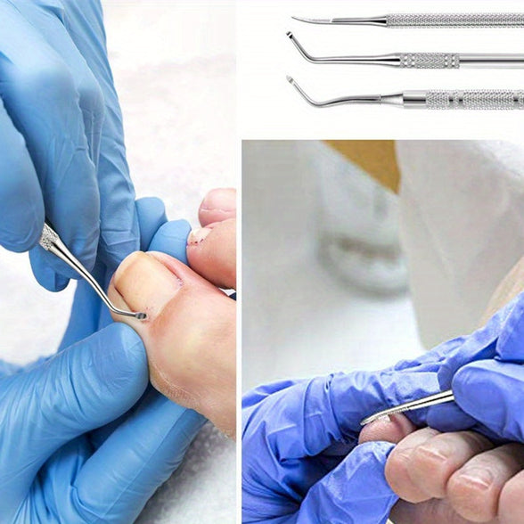 Professional Stainless Steel Ingrown Toenail