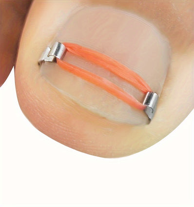 Ingrown Toenail Correction Kit with Nail Hooks Rubber Rings Crochet Needle and Tape for Effective Treatment