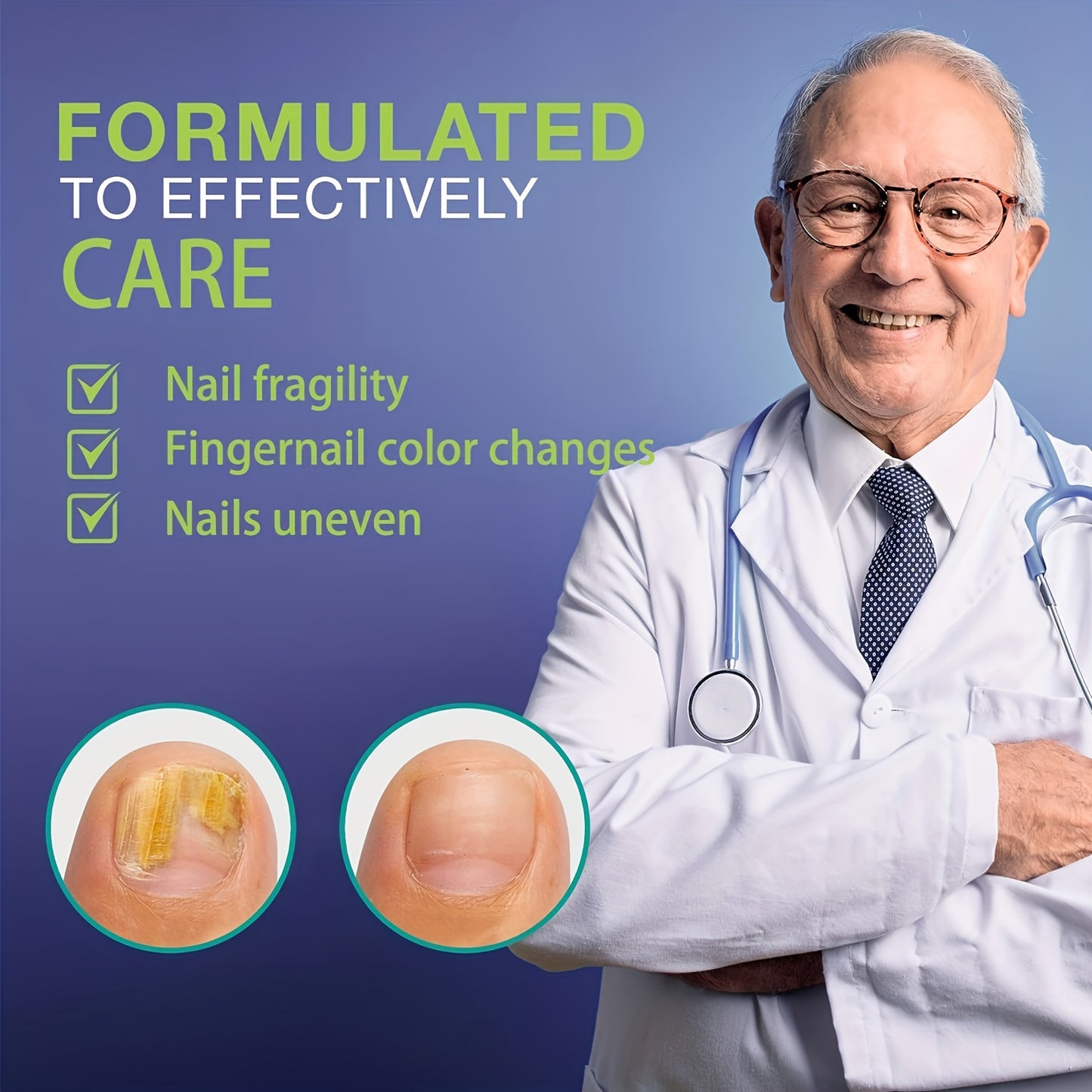 Clear Steps: Extra Strength Toenail Fungus Treatment - Renew Your Toenails for Healthy Shine!