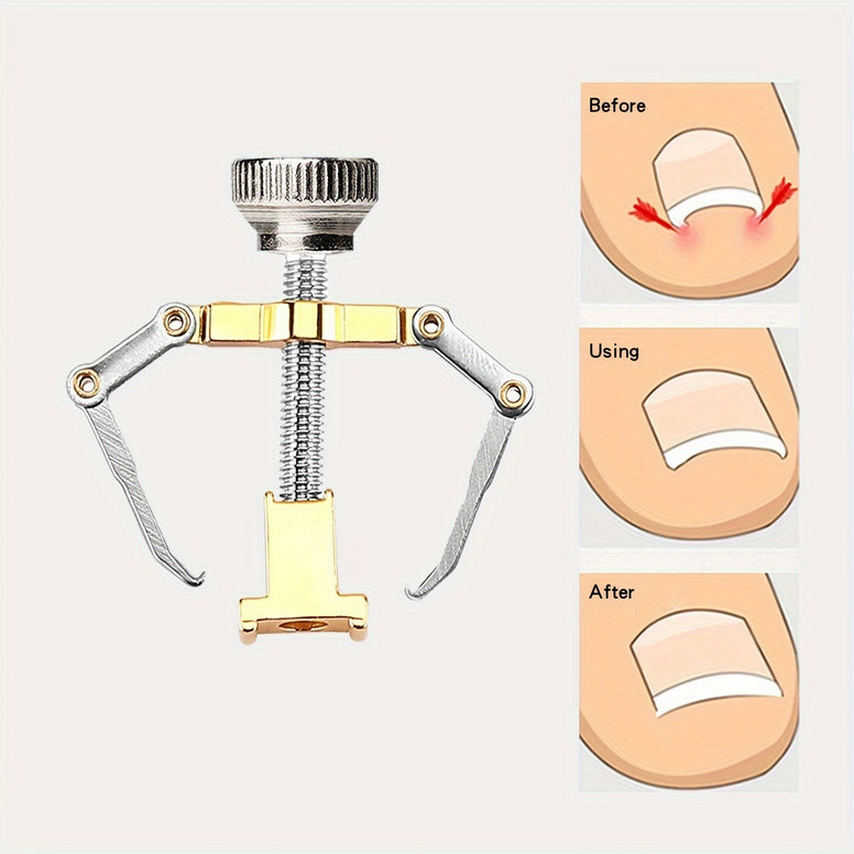 Professional Ingrown Nail Corrector Tool for Ingrown Toenail Care