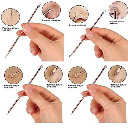 Remover Blackhead Remover Pimple Tool Kit, Set of 4 Stainless Steel Blackhead Removal Tool Pimple Popping Kit, Pimple Extractor Acne Tool