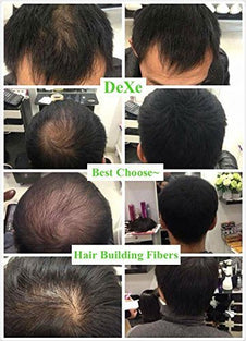 Dexe Classic Necessity Lose Hair Building Fibres, 22g (Black)