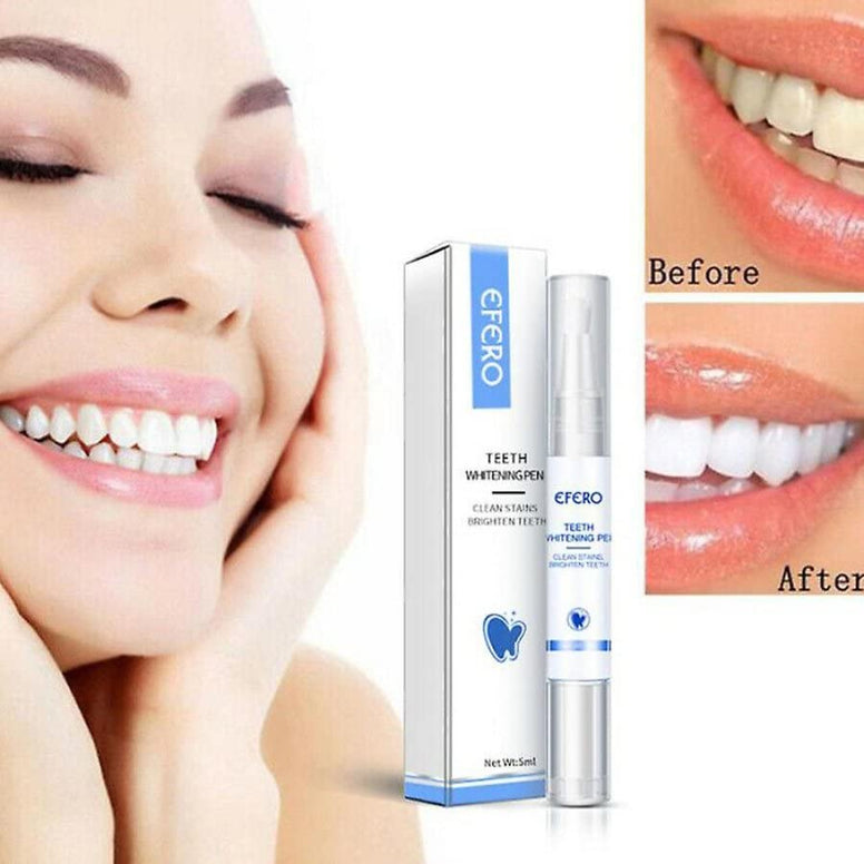 KANZA - Teeth Whitening Essence,Teeth Whitening Pen Set | Oral Hygiene, Tooth Bleaching | Fast-Acting Teeth Whitener | Teeth Cleaning Serum | Teeth Nourishing Agent, Removes Plaque Stains