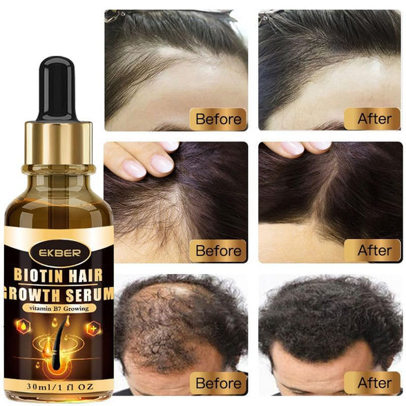 Ekber Organic Rosemary Hair Growing Oil with Biotin & Vitamin B7 for Daily Scalp & Hair Growth, Nourish & Repair, Split End Treatment & Strengthening