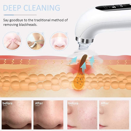 HICITI 5 in 1 EMS Face Lift Devices Microcurrent Skin Rejuvenation Facial Massager Light Therapy Anti Aging Wrinkle And Bubble Blackhead Remover Pore Acne Removal Vacuum Suction Comedo