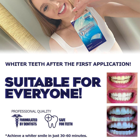 LOVELY SMILE Premium Line Teeth Whitening Strips - Enamel Safe - White Teeth in 1 Hour - No Slip and No Sensitivity - Dental Whitener Kit by Ray of Smile (28 Strips)