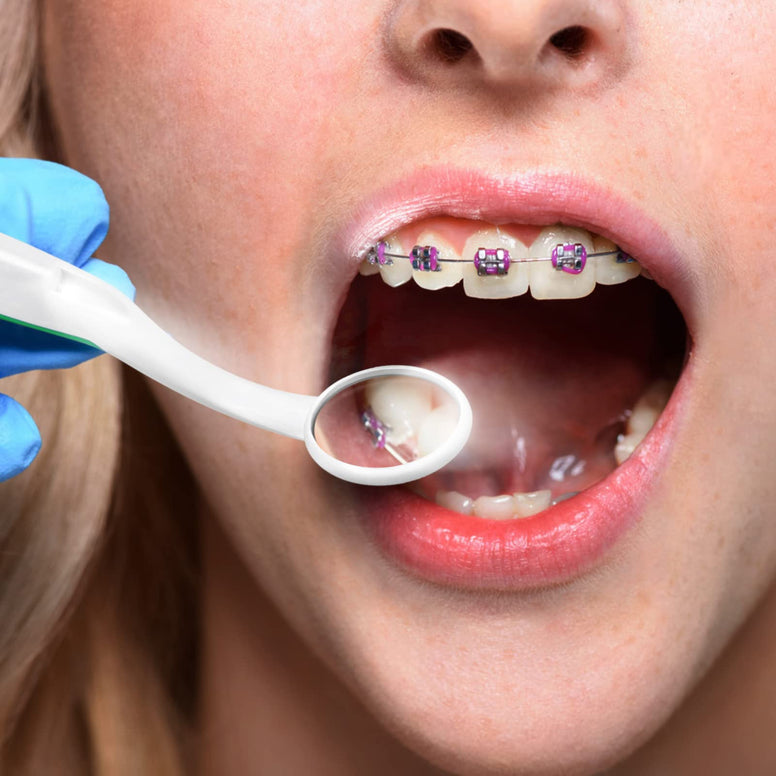 ULTNICE LED Dental Mirror 2Pcs LED Lighted Oral Mirrors Anti- fog Dental Mouth Mirrors with Light Dentist Teeth Inspection Oral Care Tool