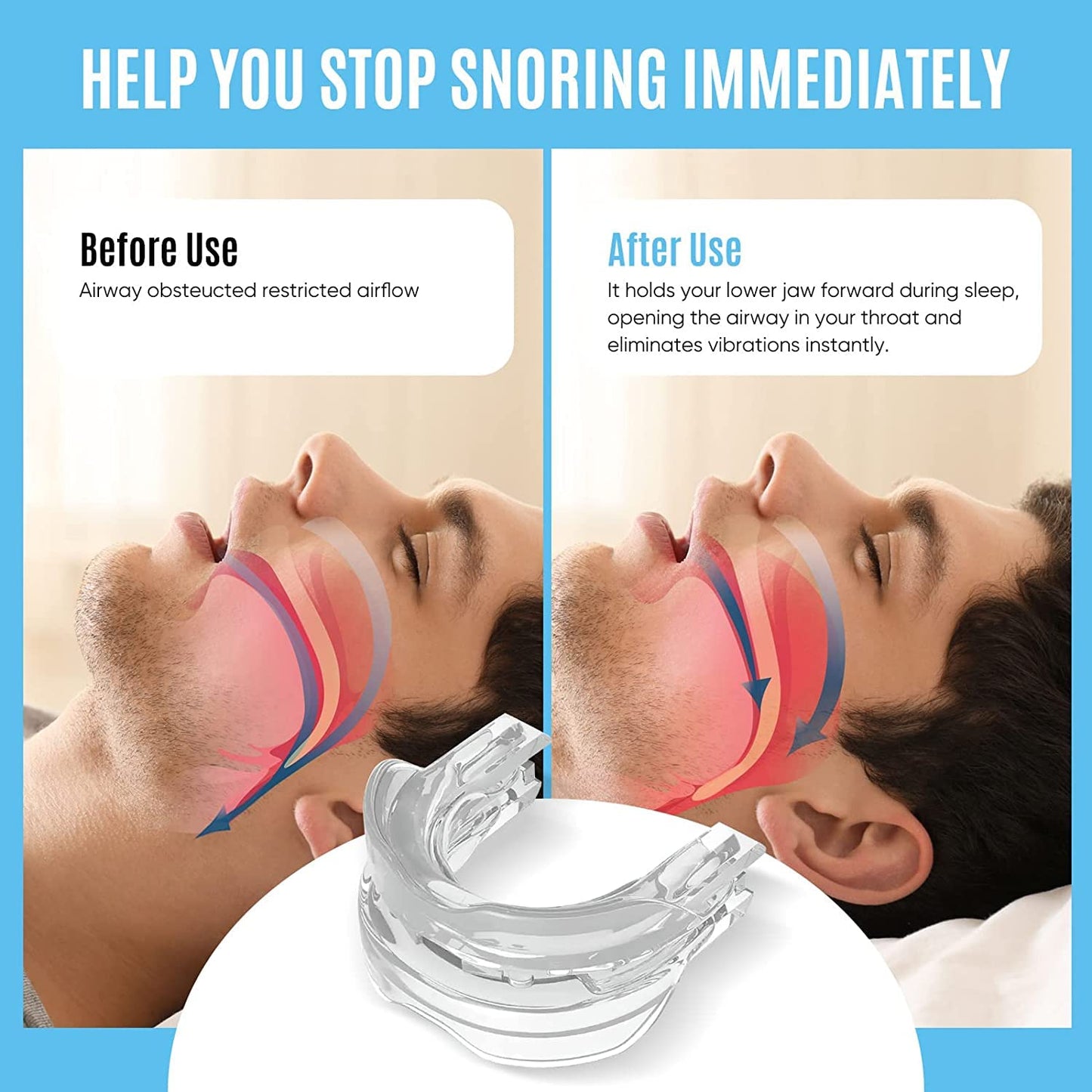 Stop Snoring Mask, Stop Snoring Device, Help Stop Snoring, Reduce Snoring Solution, Comfortable, Adjustable, Suitable for Men/Women. Allow people to get a good and restful night's sleep.