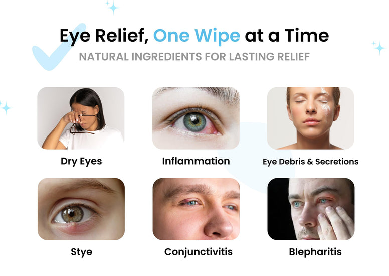Blepharitis Eyelid Wipes – 20 Pack Individually Wrapped - For Daily Eyelid Hygiene, Natural Ingredients, Relief for Blepharitis, Tired and Dry Eyes