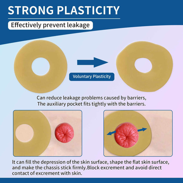 Ostomy Medical Supplies Barrier Ring-Barrier Rings Better Seal for Ostomy Bags-Stoma Rings,Outer Diameter: 2”48mm -4mm Thickness-Box of 10