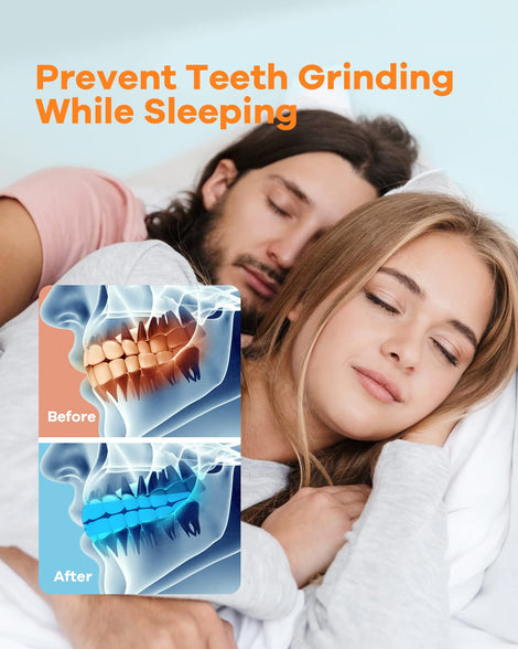 SmileShark Mouth Guard (4 Count), Mouth Guard for Clenching Teeth at Night, Night Guard for Clenching, Night Guards for Teeth Grinding, Mouth Guard for Grinding Teeth (2 Regular & 2 Heavy Duty)