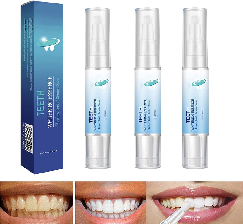 SYOSI Teeth Whitening Essence Pen, Teeth Whitening Pen, Purely White Deluxe Teeth Whitening Kit, Fast and Effective Removal Tooth Stain Removal