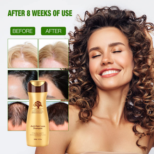 Anti Hair Loss Shampoo, ARGANMIDAS Thinning Hair Shampoo for Women & Men Thinning & Fall Hair & All Hair Types Stimulates Hair Growth 300ML